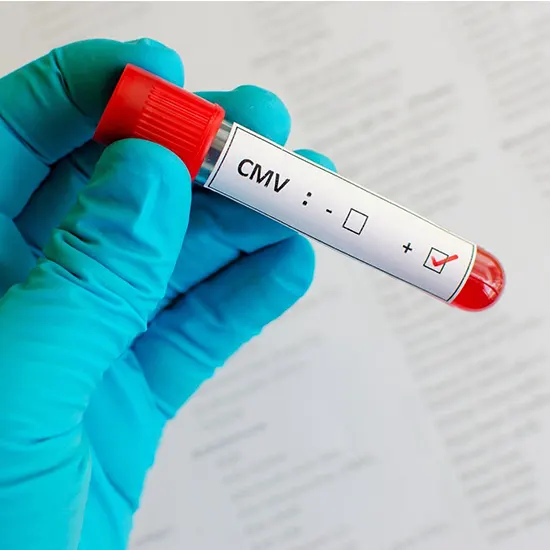 CMV Qualitative PCR-Cytomegalovirus Test